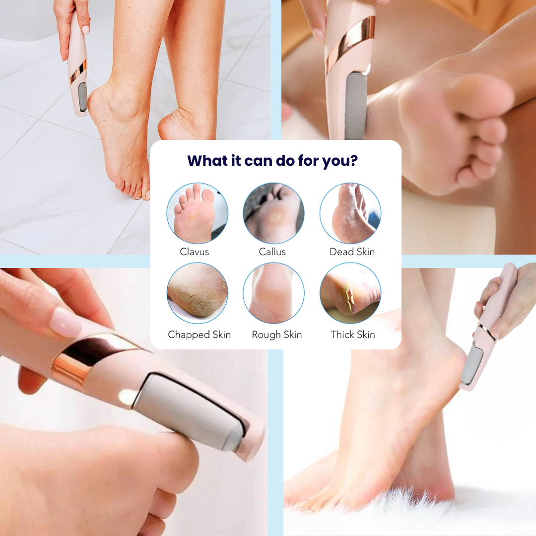 Leorisa™  Electric Foot Callus Remover