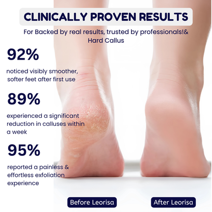 Leorisa Electric Callus Remover
